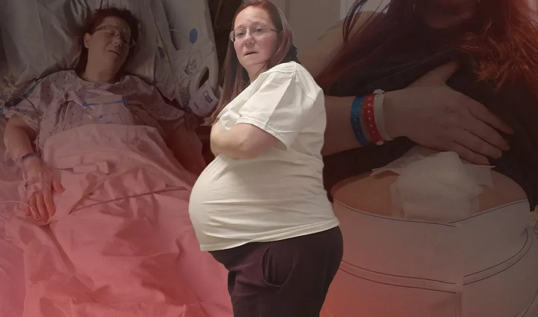 ABD'de karın şişliği ve hızlı kilo artışı şikayetiyle doktora giden